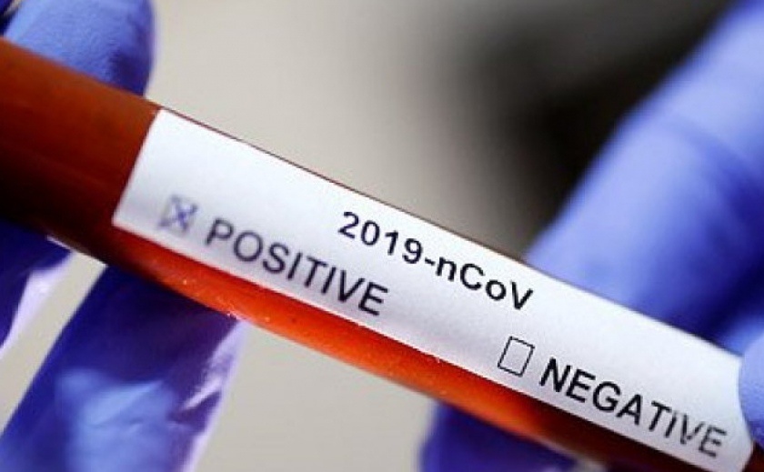 Новые зараженные COVID-19 в Каменском оказались из контактной группы риска