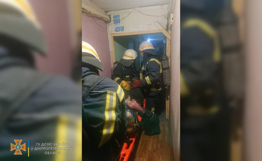 Ожоги руки и грудной клетки: в Каменском на пожаре пострадал мужчина